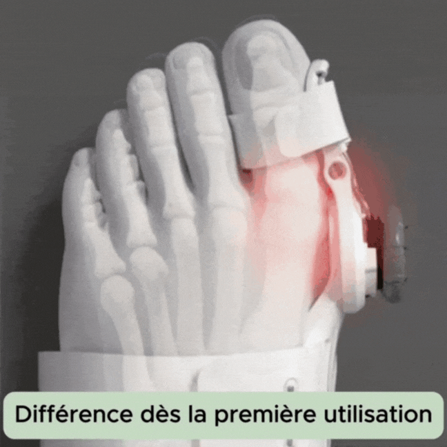 Toe bunion corrector-Hallux Valgus Correction