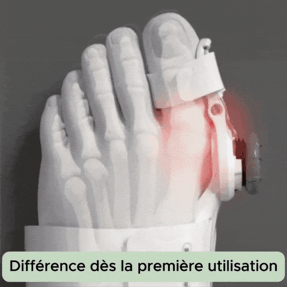 Toe bunion corrector-Hallux Valgus Correction
